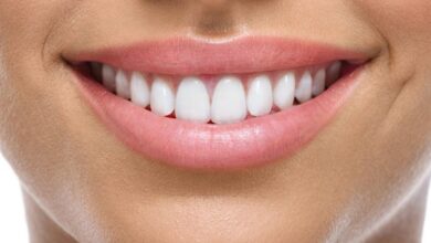 Porselen Kaplama Diş: Gülümsemenize Işık Katacak Estetik Çözüm